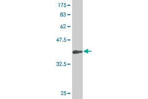 Western Blotting (WB) image for anti-Succinate Dehydrogenase Complex, Subunit C, Integral Membrane Protein, 15kDa (SDHC) (AA 1-169) antibody (ABIN562832)