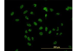 Immunofluorescence of monoclonal antibody to TBL1XR1 on HeLa cell. (TBL1XR1 Antikörper  (AA 81-178))
