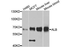 Western blot analysis of extracts of various cell lines, using ALB antibody. (Albumin Antikörper  (AA 20-255))