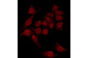 ABIN6267551 staining HeLa by IF/ICC. (STAT2 Antikörper  (pTyr690))