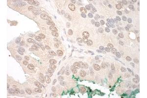 anti-Origin Recognition Complex Subunit 2 (ORC2) (AA 1-50) antibody