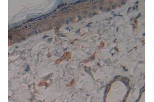 Immunohistochemistry (IHC) image for anti-Ring Finger Protein 112 (RNF112) (AA 256-504) antibody (ABIN7442381)