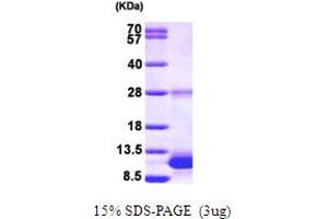 SDS-PAGE (SDS) image for S100 Calcium Binding Protein B (S100B) (AA 1-92) protein (His tag) (ABIN667150)