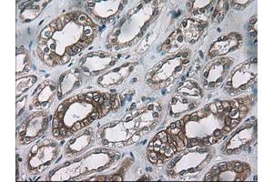 Image no. 1 for anti-Keratin 18 (KRT18) (AA 69-372) antibody (ABIN1491639) (Cytokeratin 18 Antikörper  (AA 69-372))