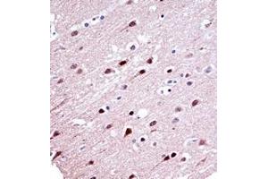 Immunohistochemistry analysis in formalin fixed and paraffin embedded human brain tissue reacted with  KCND2 Antibody (N-term) followed which was peroxidase conjugated to the secondary antibody and followed by DAB staining.