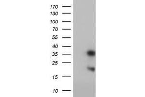 Western Blotting (WB) image for anti-Frataxin (FXN) antibody (ABIN1498335) (Frataxin Antikörper)