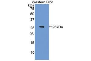 Western blot analysis of recombinant Human Gelsolin. (Gelsolin Antikörper  (AA 577-771))