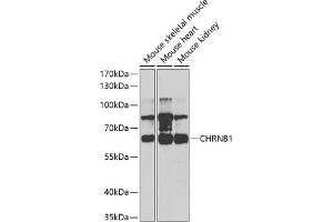 Western blot analysis of extracts of various cell lines, using CHRNB1 antibody (ABIN6131211, ABIN6138587, ABIN6138588 and ABIN6220911) at 1:1000 dilution. (CHRNB1 Antikörper  (AA 25-235))