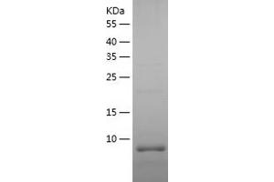 Western Blotting (WB) image for Chromosome 10 Open Reading Frame 99 (C10ORF99) (AA 25-81) protein (His tag) (ABIN7287693) (C10orf99 / CSBF Protein (AA 25-81) (His tag))