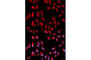 Immunofluorescence (IF) image for anti-Hydroxysteroid (17-Beta) Dehydrogenase 10 (HSD17B10) antibody (ABIN1876636) (HSD17B10 Antikörper)