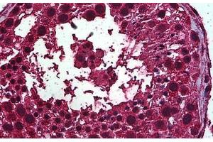 Human Testis: Formalin-Fixed, Paraffin-Embedded (FFPE) (Retinoic Acid Receptor alpha Antikörper  (AA 315-425))