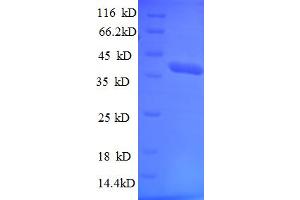 SDS-PAGE (SDS) image for Tripartite Motif Containing 11 (TRIM11) (AA 267-468), (partial) protein (His-SUMO Tag) (ABIN5711713)