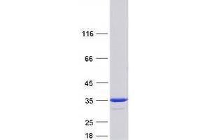 Western Blotting (WB) image for phosphoglycerate Mutase 2 (Muscle) (PGAM2) protein (Myc-DYKDDDDK Tag) (ABIN2728777)