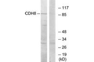 Western Blotting (WB) image for anti-Cadherin 8 (CDH8) (AA 491-540) antibody (ABIN2889888) (Cadherin 8 Antikörper  (AA 491-540))