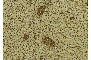 ABIN6272258 at 1/100 staining Mouse liver tissue by IHC-P. (BRD3 Antikörper  (C-Term))