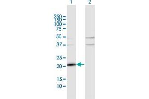 Western Blot analysis of TMEM126B expression in transfected 293T cell line by TMEM126B MaxPab polyclonal antibody. (TMEM126B Antikörper  (AA 1-200))