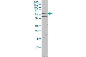 NR1H2 monoclonal antibody (M01), clone 2H2-H3 Western Blot analysis of NR1H2 expression in LNCaP . (NR1H2 Antikörper  (AA 1-461))