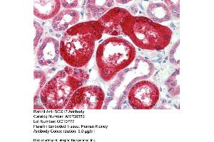 Rabbit Anti-SOX17 Antibody  Paraffin Embedded Tissue: Human Kidney Antibody Concentration: 5 ug/ml (SOX17 Antikörper  (Middle Region))