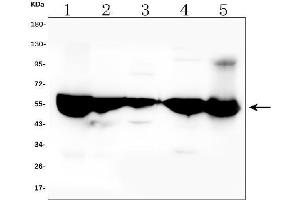Western blot analysis of ALDH2 using anti-ALDH2 antibody (ABIN7603107).