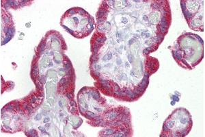 Immunohistochemistry with Placenta tissue at an antibody concentration of 5µg/ml using anti-KRT23 antibody (ARP47466_P050) (KRT23 Antikörper  (Middle Region))