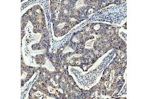 IHC analysis of TOMM20 using anti-TOMM20 antibody (ABIN7600883). (TOMM20 Antikörper  (AA 25-145))