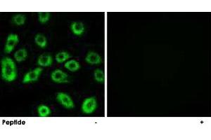 Immunofluorescence analysis of A-549 cells, using ATP5D polyclonal antibody . (ATP5F1D Antikörper)