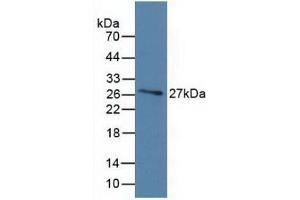 Detection of Recombinant DBP, Human using Monoclonal Antibody to Vitamin D Binding Protein (DBP) (Vitamin D-Binding Protein Antikörper  (AA 209-401))