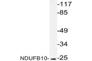 Western blot (WB) analysis of NDUFB10 antibody in extracts from COLO cells. (NDUFB10 Antikörper)