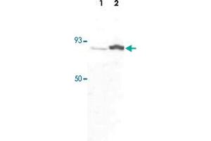 Western blot was performed using whole cell extracts (WCE) from drosophila larva (Lane 1) and drosophila adults (Lane 2) and the CDC73 polyclonal antibody  at dilution 1 : 1,000 in TBS-Tween + 5% skimmed milk. (HRPT2 Antikörper)