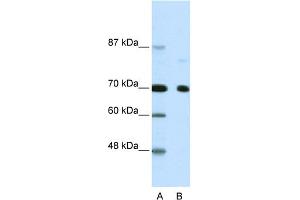 WB Suggested Anti-NCOR2 Antibody Titration:  2. (NCOR2 Antikörper  (N-Term))