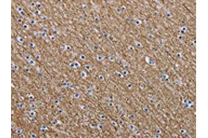 The image is immunohistochemistry of paraffin-embedded Human brain tissue using ABIN7191618(NEFM Antibody) at dilution 1/20. (NEFM Antikörper)