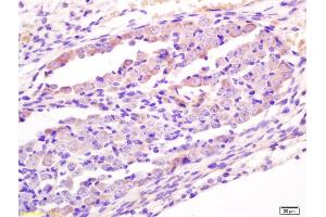 Immunohistochemistry (IHC) image for anti-Wingless-Type MMTV Integration Site Family, Member 1 (WNT1) (AA 251-350) antibody (ABIN733748)