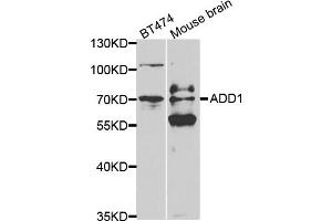 Western blot analysis of extracts of various cell lines, using ADD1 antibody (ABIN5970770) at 1/500 dilution. (alpha Adducin Antikörper)