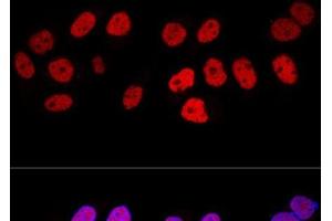 Confocal immunofluorescence analysis of HeLa cells using DNMT1 Polyclonal Antibody at dilution of 1:100. (DNMT1 Antikörper)