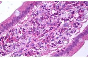 Anti-VEGFR3 antibody IHC staining of human small intestine. (FLT4 Antikörper)