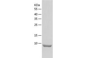 Western Blotting (WB) image for Osteocrin (OSTN) (AA 28-133) protein (His tag) (ABIN7124279)