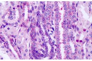 Anti-FZD8 / Frizzled 8 antibody IHC staining of human fetal kidney. (FZD8 Antikörper  (Extracellular Domain))