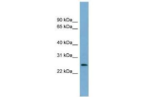 LIN37 antibody used at 1 ug/ml to detect target protein. (LIN37 Antikörper)
