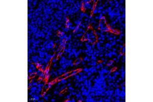 Immunofluorescence (Paraffin-embedded Sections) (IF (p)) image for anti-Homer Homolog 3 (Drosophila) (HOMER3) antibody (ABIN7074257)