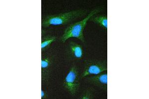 IF analysis of CCT2 using anti-CCT2 antibody (ABIN4886512). (CCT2 Antikörper  (AA 414-535))