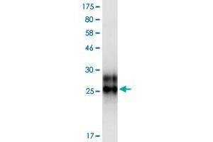 Western Blotting (WB) image for Tumor Necrosis Factor Receptor Superfamily, Member 19 (TNFRSF19) (AA 30-170) protein (His-DYKDDDDK-Strep II Tag) (ABIN4369899)