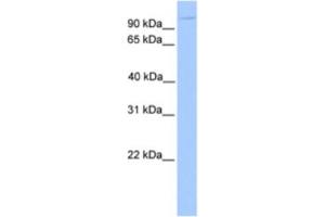 Western Blotting (WB) image for anti-Nucleoporin 98kDa (NUP98) antibody (ABIN2463586) (NUP98 Antikörper)