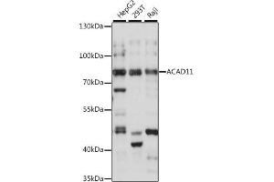 Western blot analysis of extracts of various cell lines, using  antibody (ABIN7265417) at 1:1000 dilution. (ACAD11 Antikörper  (AA 1-230))