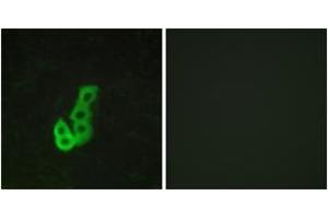 Immunofluorescence analysis of MCF7 cells, using DRD1 Antibody. (Dopamine Receptor d1 Antikörper  (AA 135-184))