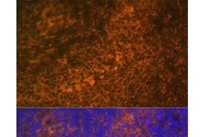 Immunofluorescence analysis of Rat spleen using TNFRSF10A Polyclonal Antibody at dilution of 1:100 (40x lens). (TNFRSF10A Antikörper)