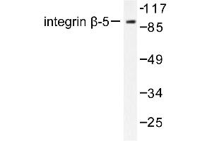 Image no. 1 for anti-Integrin beta 5 (ITGB5) antibody (ABIN265481) (Integrin beta 5 Antikörper)