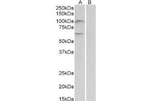 ABIN2560674 (2µg/ml) staining of Human Bone Marrow lysate (35µg protein in RIPA buffer) with (B) and without (A) blocking with the immunizing peptide.
