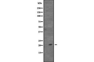 Western blot analysis of CDC42 expression in Hela cell lysate,The lane on the left is treated with the antigen-specific peptide.