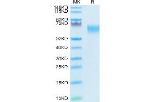 Biotinylated Human TGF-beta RII on Tris-Bis PAGE under reduced condition. (TGFBR2 Protein (AA 24-159) (mFc-Avi Tag,Biotin))