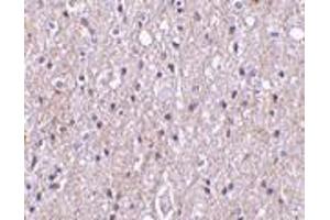 Immunohistochemistry of CTRP4 in human brain tissue with CTRP4 antibody at 10 μg/ml. (C1QTNF4 Antikörper  (N-Term))